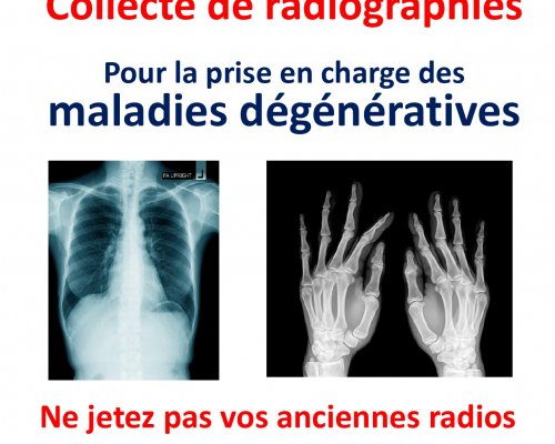 Collecte de radiographies à Laxou